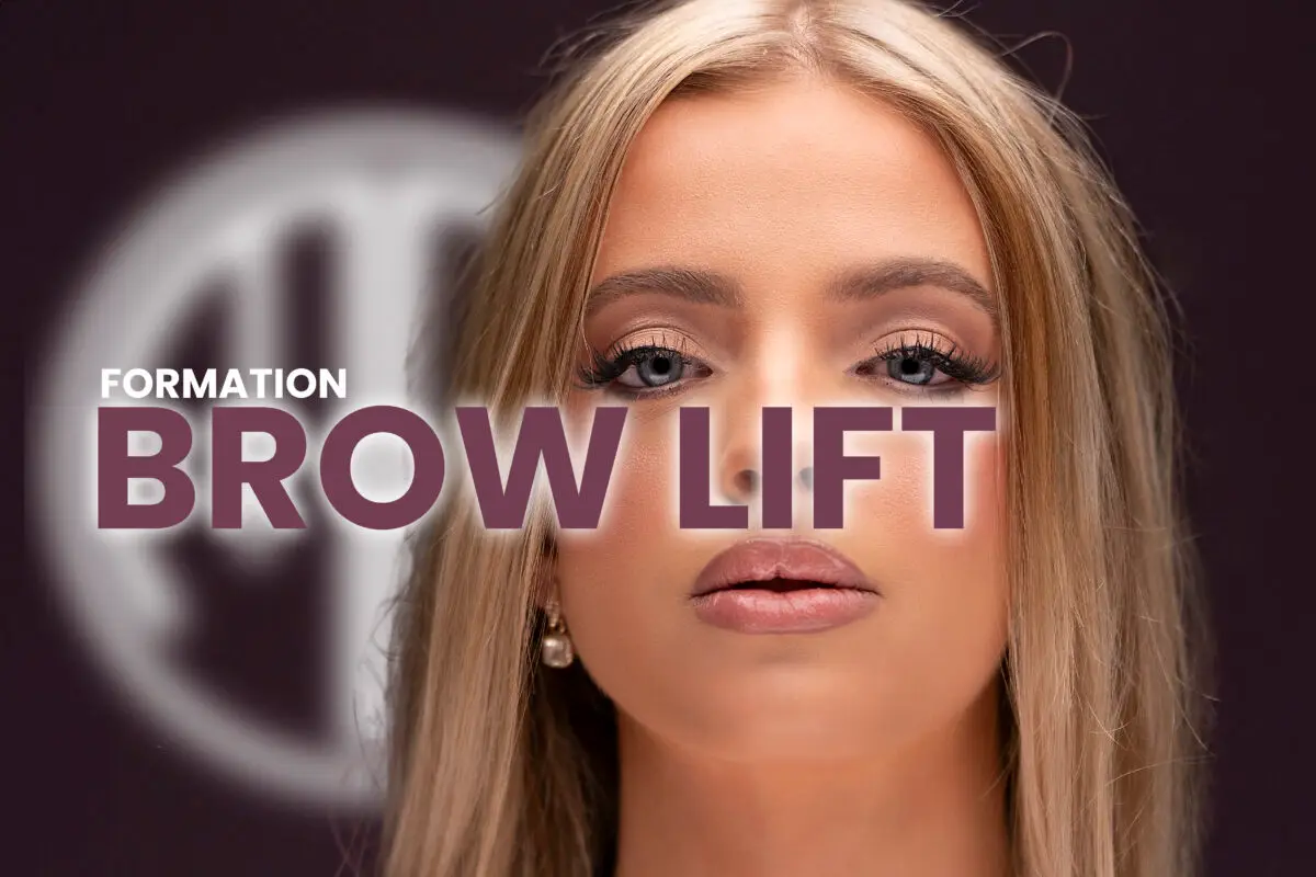 Brow lift