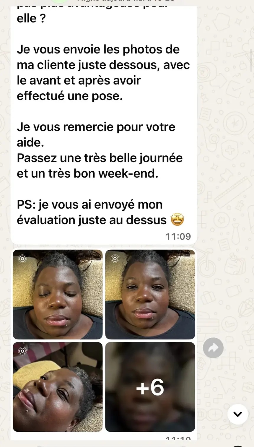 Photos avant et après envoyées à notre équipe pour un avis